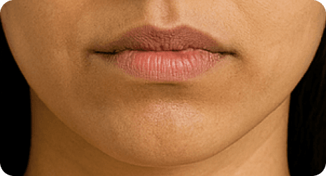 Novaclear Whiten Rosy Lip Balm spf 50+