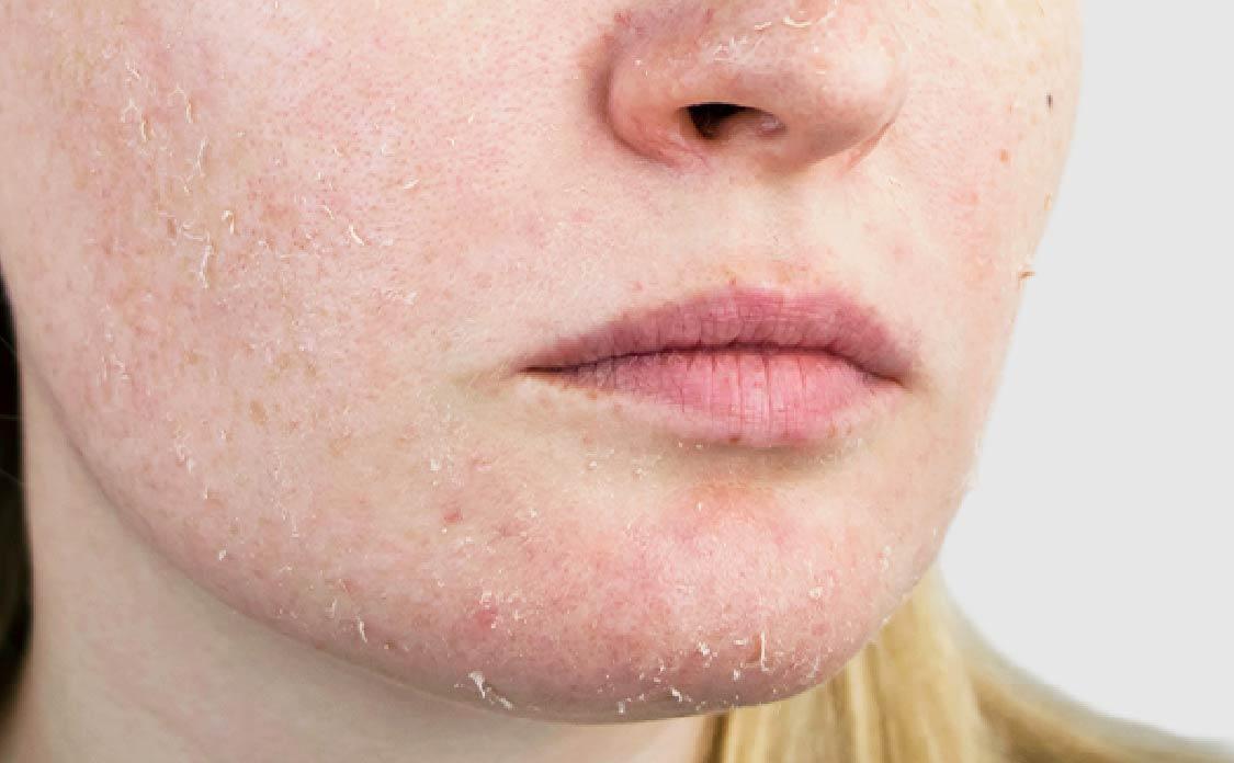 Larel Dermo Lift Skin Reneval Face Wash