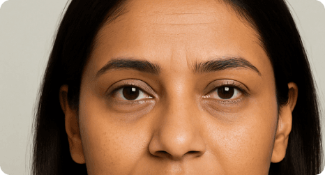 Novaclear Redless Soothing Day Cream