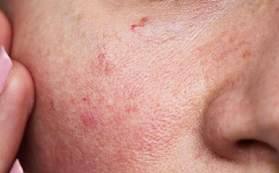 Skin Transformation LumiGlow Exosome Maskpack